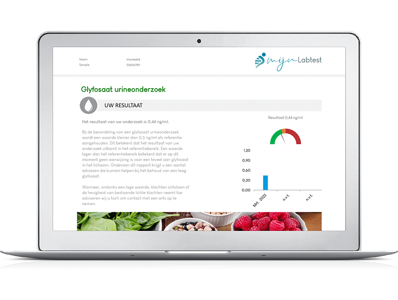 Pick & mix urinetest - Afbeelding 2
