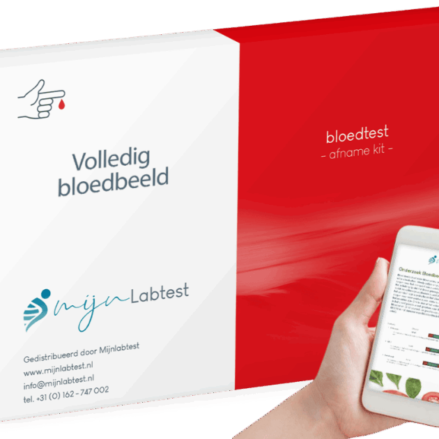 Volledig bloedbeeld